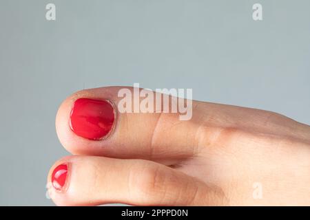 Femme gros orteil avec vernis à ongles rouge et cheveux longs, concept d'épilation et traitement esthétique. Soins des pieds et pédicure Banque D'Images