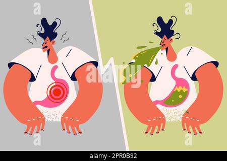 L'homme malsain souffre d'indigestion et de vomissements Illustration de Vecteur