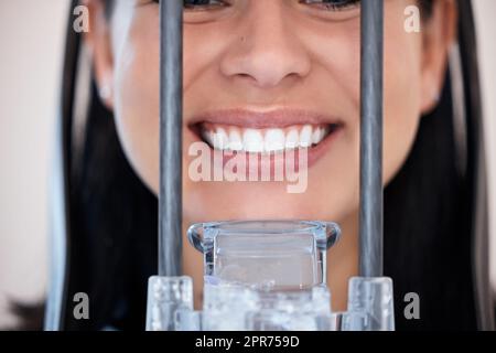 Gros plan d'une femme qui obtient un scanner numérique de sa bouche à rayons X chez le dentiste. Une femme qui sourit seulement pour un examen dentaire. Patient prenant soin de son hygiène buccale pour maintenir des dents et des gencives saines Banque D'Images