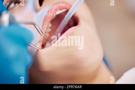 Personne n'aime cette partie. Une femme se fait nettoyer ses dents par son dentiste. Banque D'Images