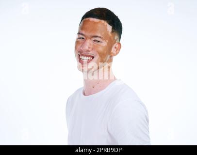 J'aime toujours les projecteurs. Portrait d'un beau jeune homme avec le vitiligo posé sur un fond blanc. Banque D'Images