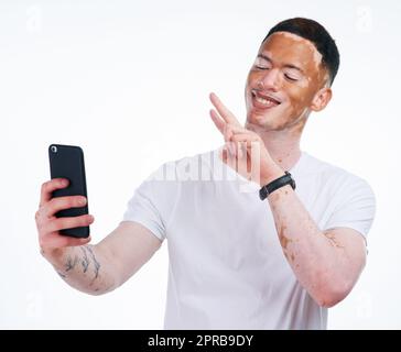 Im pas différent, IM édition limitée. Portrait d'un beau jeune homme avec vitiligo prenant un selfie avec un téléphone portable sur fond blanc. Banque D'Images