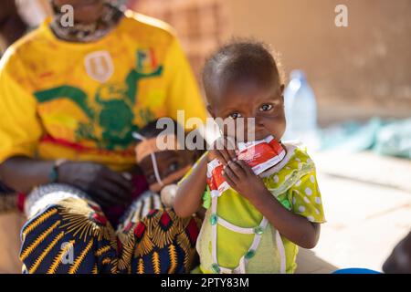 Enfant mangeant la nourriture thérapeutique Plumpy'nut alors qu'il est à l'hôpital pour la malnutrition dans la région de Segou, Mali, Afrique de l'Ouest. 2022 crise de la sécheresse et de la faim au Mali. Banque D'Images