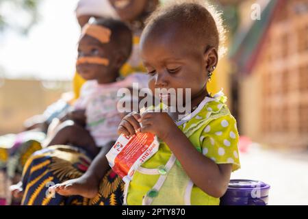 Enfant mangeant la nourriture thérapeutique Plumpy'nut alors qu'il est à l'hôpital pour la malnutrition dans la région de Segou, Mali, Afrique de l'Ouest. 2022 crise de la sécheresse et de la faim au Mali. Banque D'Images