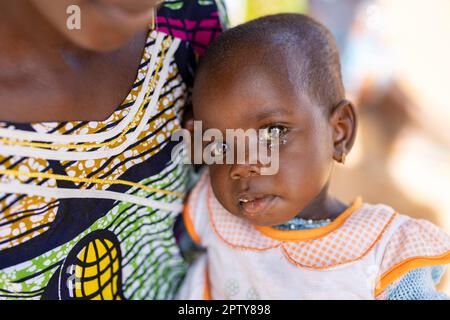 Mère et jeune enfant admis à l'hôpital pour malnutrition et paludisme dans la région de Ségou, Mali, Afrique de l'Ouest. 2022 crise de la sécheresse et de la faim au Mali. Banque D'Images