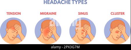 Types de maux de tête. Zones de migraines diagramme infographique poster médical, douleur cérébrale dans la tête sinus tension ou cluster de migraine, partie anatomique de l'hôpital patient vecteur illustration de la douleur tête et des maux de tête Illustration de Vecteur