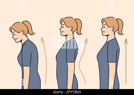 Ensemble de correction de posture de jeune femme. Collection de femmes avec et sans problèmes de dos. Soins de santé et physiothérapie. Illustration vectorielle. Banque D'Images