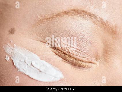 Soins de la peau, albinos et femme avec crème solaire closeup pour le bien-être, le soin de la peau et du visage de produit de crème. Visage, fille et zoom sur le modèle albiniste se détendre avec des soins des yeux, crème solaire et routine de beauté Banque D'Images