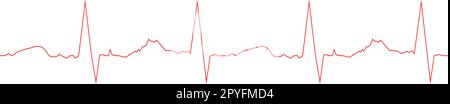 Modèle d'électrocardiogramme. Diagramme des battements cardiaques. Le dossier ECG est isolé sur fond blanc. Ligne rouge de rythme cardiaque. Panneau de test cardio. Hôpital de cardiologie Illustration de Vecteur