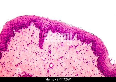 Épithélium squameux stratifié humain sous microscope, micrographe léger Banque D'Images