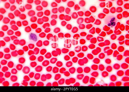 Frottis de sang humain au microscope, photomicrographe léger Banque D'Images