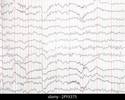 encéphalogramme sur papier - trace de l'activité électrique du cerveau humain Banque D'Images