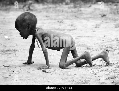 SDN , SOUDAN : Un garçon malnutris dans un centre d'alimentation d'Ayod dans le sud du Soudan 12.08.1993 Banque D'Images