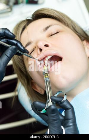 Le dentiste administre l'anesthésie au patient avant le traitement dentaire. Assurer le confort pendant le retrait des caries Banque D'Images
