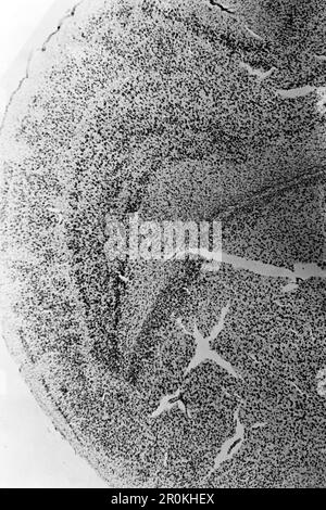Ansicht eines Dünnschnitts durch ein Gehirn, 1938. Vue d'une section mince à travers un cerveau, 1938. Banque D'Images