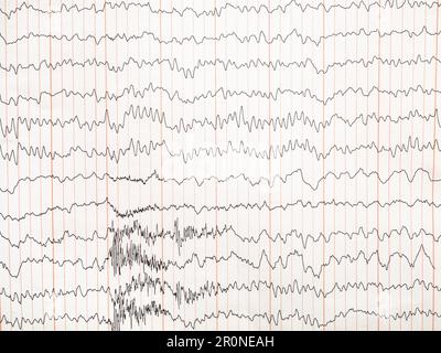 encéphalogramme sur papier - enregistrement de l'activité électrique du cerveau Banque D'Images