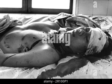 Une des 48 personnes blessées par une explosion de Viet Cong qui a tué 14 personnes à Saigon attend des soins à l'hôpital de Cong Hoa. L'explosion a été mise en marche dans un coin de rue très animé et les victimes étaient des femmes et des enfants. Février 1966. Banque D'Images