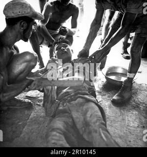 Un prisonnier de Viehminh blessé est secouriste par des médecins franco-vietnamiens après un incendie près de Hung yen, au sud de Hanoï. Vers 1954 Banque D'Images
