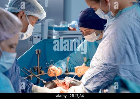 Une équipe de chirurgiens effectuant soigneusement la chirurgie en utilisant des instruments précis dans la salle d'opération sauver la vie du patient, un travail d'équipe clair. Banque D'Images