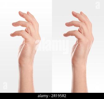 Collage avec des photos d'homme montrant les mains avec une peau sèche et hydratée sur fond blanc, gros plan Banque D'Images