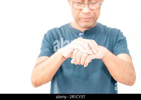 Un homme distal syndrome de Guillain-Barré (DGBS), qui se présente habituellement avec une participation principalement motrice, et est indiscernable de celui trouvé dans Banque D'Images