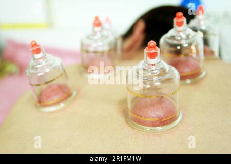 Concept image de la cupping et de la médecine, une médecine orientale traditionnelle Banque D'Images