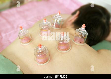 Concept image de la cupping et de la médecine, une médecine orientale traditionnelle Banque D'Images