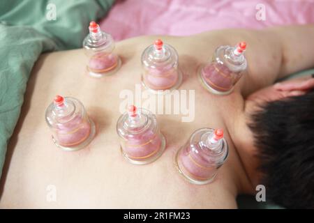 Concept image de la cupping et de la médecine, une médecine orientale traditionnelle Banque D'Images