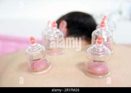 Concept image de la cupping et de la médecine, une médecine orientale traditionnelle Banque D'Images