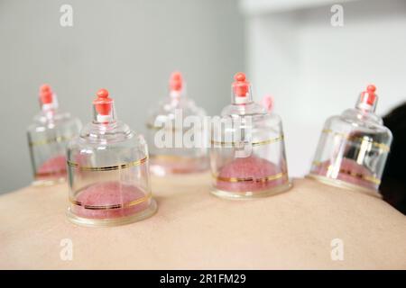 Concept image de la cupping et de la médecine, une médecine orientale traditionnelle Banque D'Images