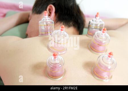 Concept image de la cupping et de la médecine, une médecine orientale traditionnelle Banque D'Images