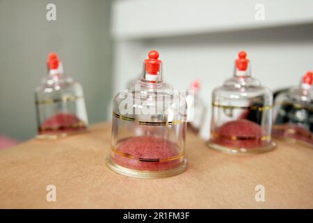 Concept image de la cupping et de la médecine, une médecine orientale traditionnelle Banque D'Images