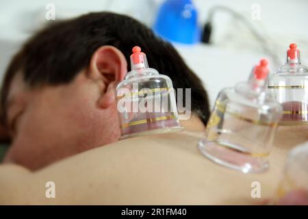 Concept image de la cupping et de la médecine, une médecine orientale traditionnelle Banque D'Images