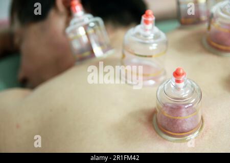 Concept image de la cupping et de la médecine, une médecine orientale traditionnelle Banque D'Images
