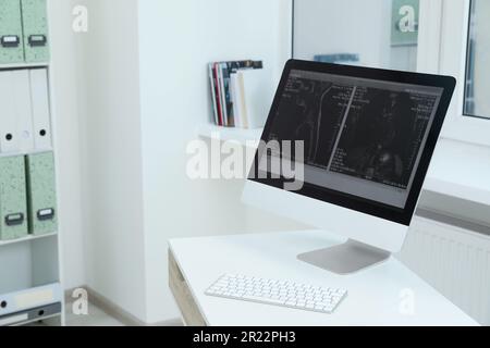 Ordinateur avec une image IRM du cou en clinique Banque D'Images