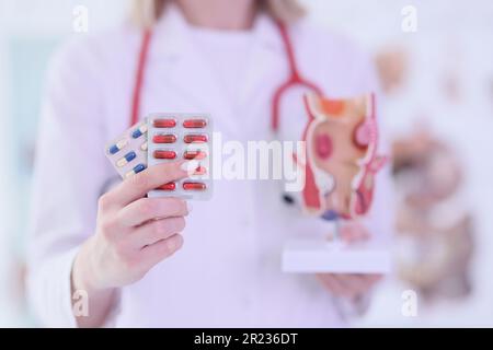 Le médecin féminin tient des pilules et le modèle du rectum dans les mains Banque D'Images