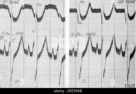 « Le processus excitatoire dans le cœur du chien. Partie II Les ventricules (1915) Banque D'Images