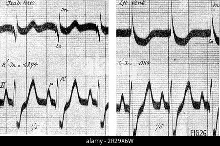 « Le processus excitatoire dans le cœur du chien. Partie II Les ventricules (1915) Banque D'Images