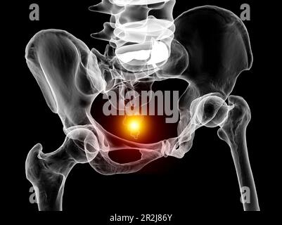 Douleur de coccyx, illustration conceptuelle Banque D'Images