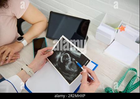 Vue du dessus mains du médecin gynécologue expliquant à la femme enceinte le développement de l'enfant dans l'utérus sur l'échographie Banque D'Images