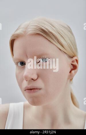 Gros plan portrait d'une jeune femme éthérée avec albinisme regardant l'appareil photo sur fond blanc Banque D'Images