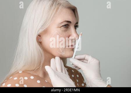 Filetage lift, concept de levage de la peau. Contour facial de la procédure à l'aide de mèsothes. Une esthéticienne en gants fait des marques avec un crayon blanc Banque D'Images