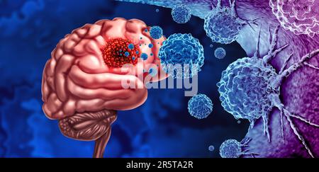 Gliome cancer tumeur comme cellules malignes déclenchement comme une maladie du cerveau attaquant les neurones comme un concept médical de maladie neurologique avec 3D illustration Banque D'Images