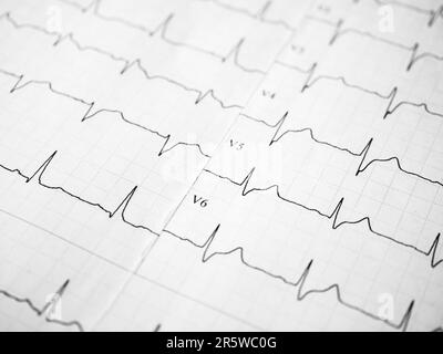 Gros plan d'un électrocardiogramme sous forme papier. Papier pour enregistrement ECG ou EKG. Le battement de cœur est indiqué sur le graphique. Concept médical et de soins de santé Banque D'Images