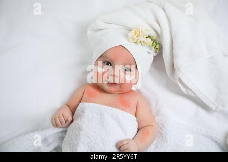 Mignon petit bébé avec crème anti-allergique sur les joues, vue du dessus. Rougeur de la peau Banque D'Images