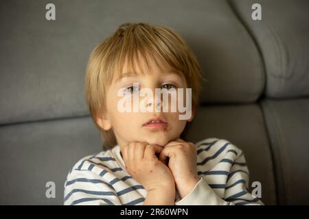 Enfant avec une éruption cutanée, roséola, maladie main-pied-et-bouche, maladie de l'éruption cutanée de l'enfant Banque D'Images