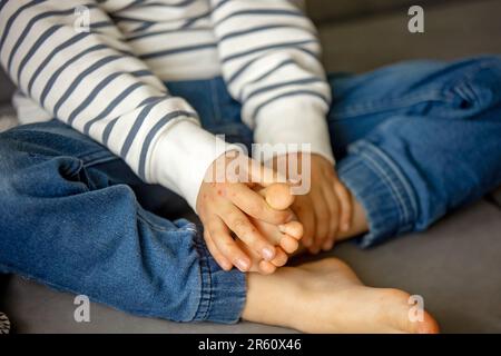 Enfant avec une éruption cutanée, roséola, maladie main-pied-et-bouche, maladie de l'éruption cutanée de l'enfant Banque D'Images