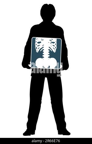 Editable vector silhouette d'un homme tenant une radiographie de l'abdomen Illustration de Vecteur