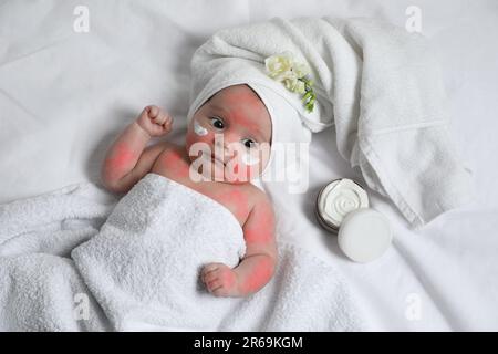 Mignon petit bébé avec crème anti-allergique sur les joues, vue du dessus. Rougeur de la peau Banque D'Images