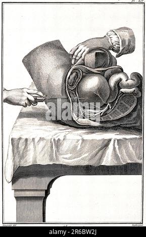 Médecine, anatomie, chirurgie, section latérale à travers l'hypogastrium, c. 1790, Historique, numériquement restauré reproduction d'un 19th siècle original / Medizin, Anomie, opération, Seitenschnitt durch das Hypogastrum, UM 1790, Historisch, digital restaurierte Reproduktion von einer Vorlage aus dem 19. Jahrhundert Banque D'Images